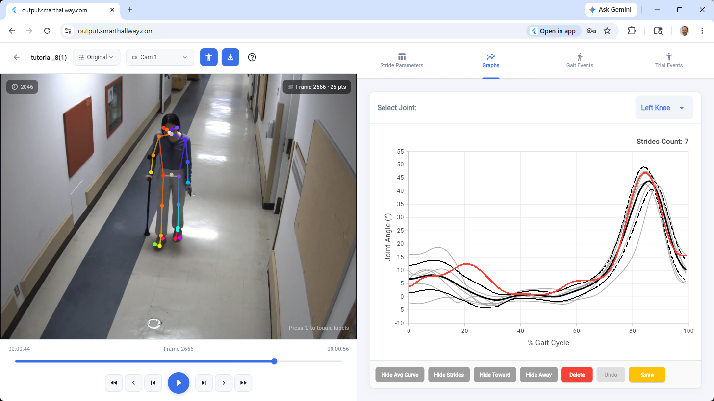 gait and movement outcome measures